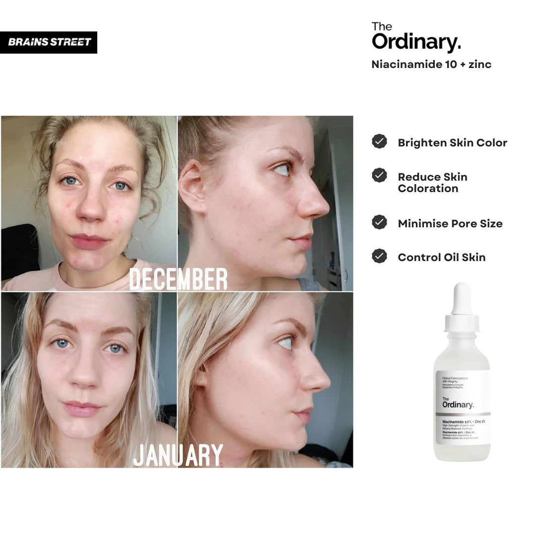 The Ordinary | NIACINAMIDE 10% + ZINC 1% - Sérum